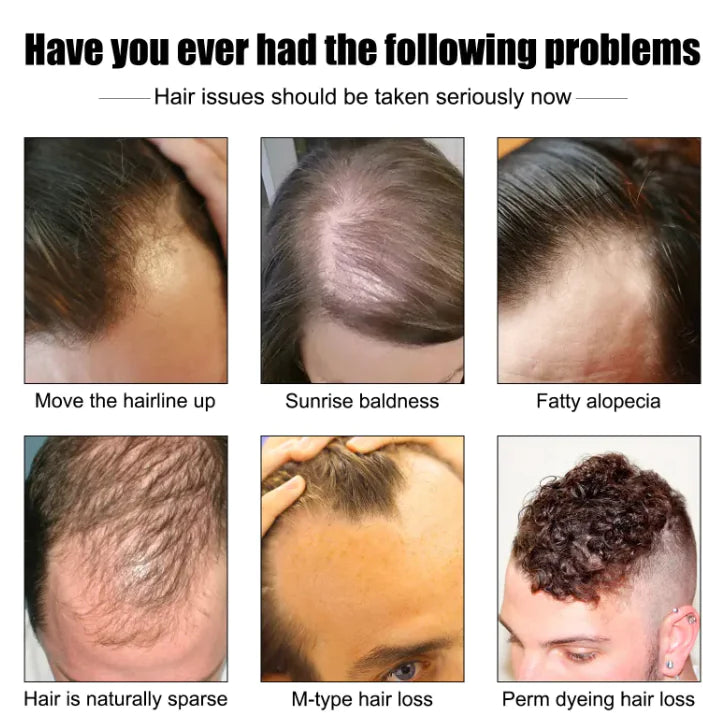 Men's Hair Growth Essence